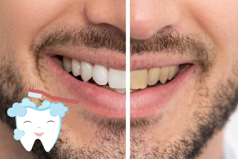 Remède de grand-mère pour enlever le jaune des dents naturellement