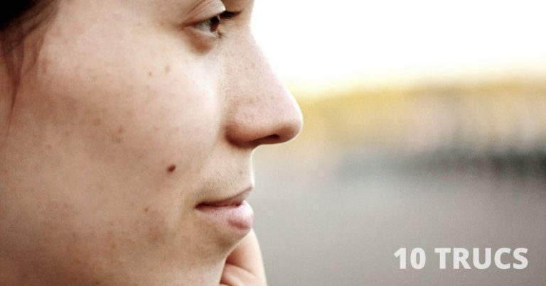 Comment enlever les taches brunes sur le visage naturellement?