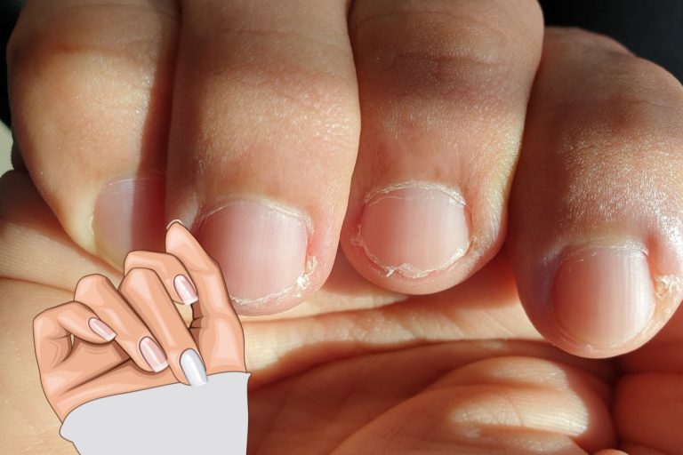 Astuces pour enlever la petite peau autours des ongles
