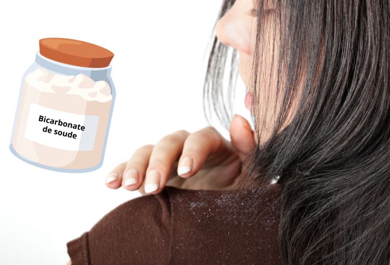 Utiliser du bicarbonate de soude contre les pellicules